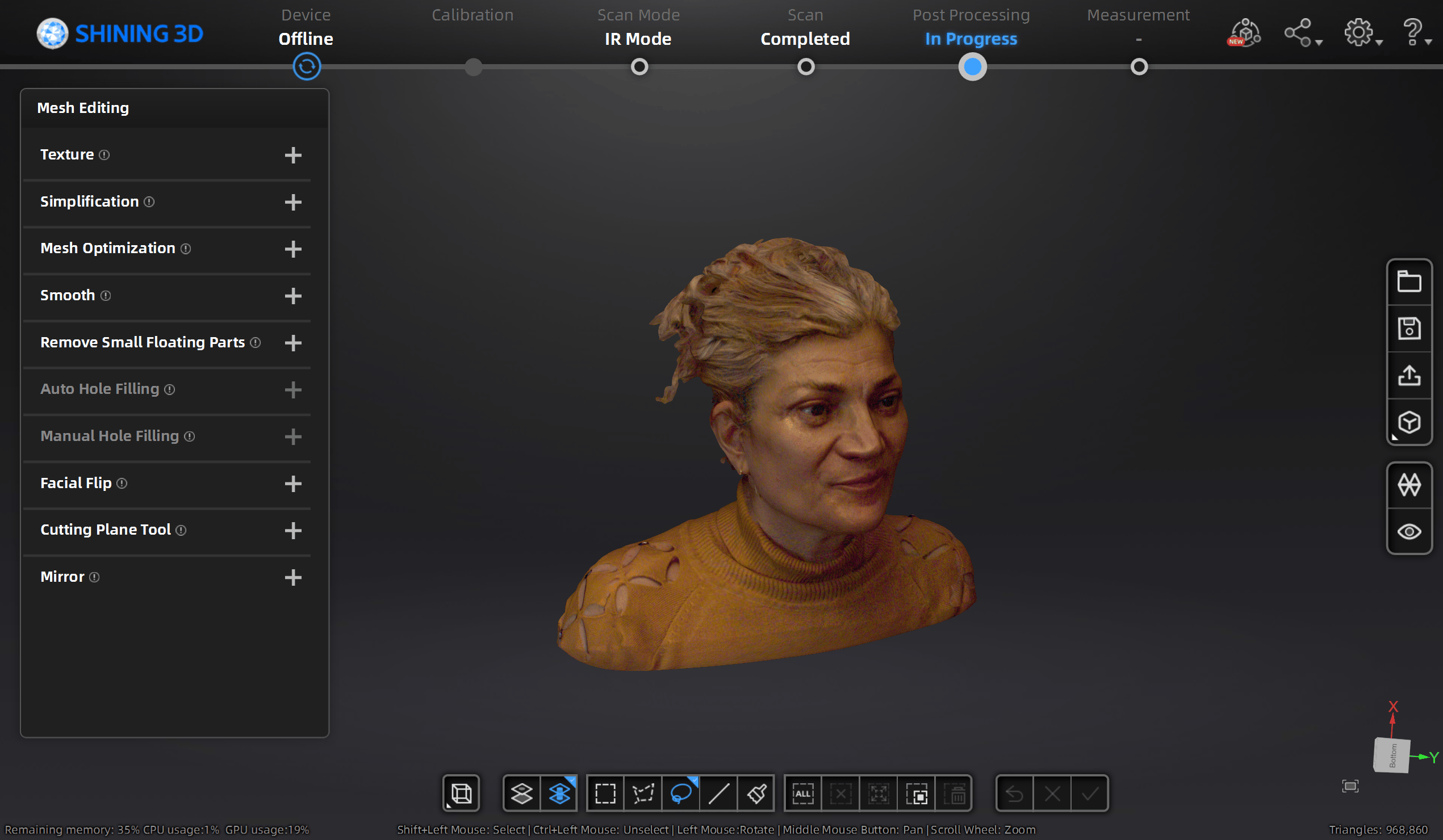 Scanare 3D faciala
